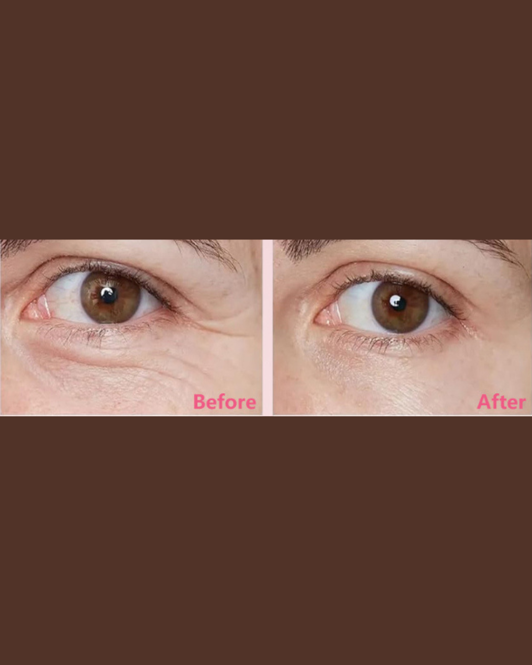 EyeLift Collagen™ — Crema Eléctrica para Ojos