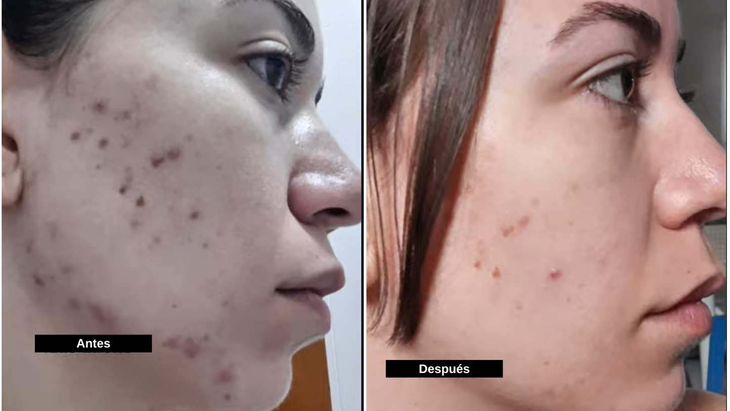 Kit Hormonal Inositol & Cortisol – Paquete de 2